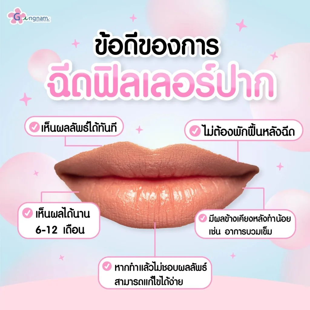 ข้อดีของการฉีดฟิลเลอร์ปาก