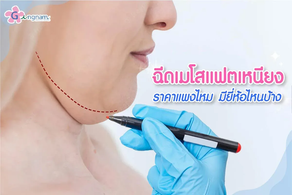 ฉีดแฟตเหนียง ลดไขมันใต้คาง แก้ปัญหาคางสองชั้น อัปเดต 2026