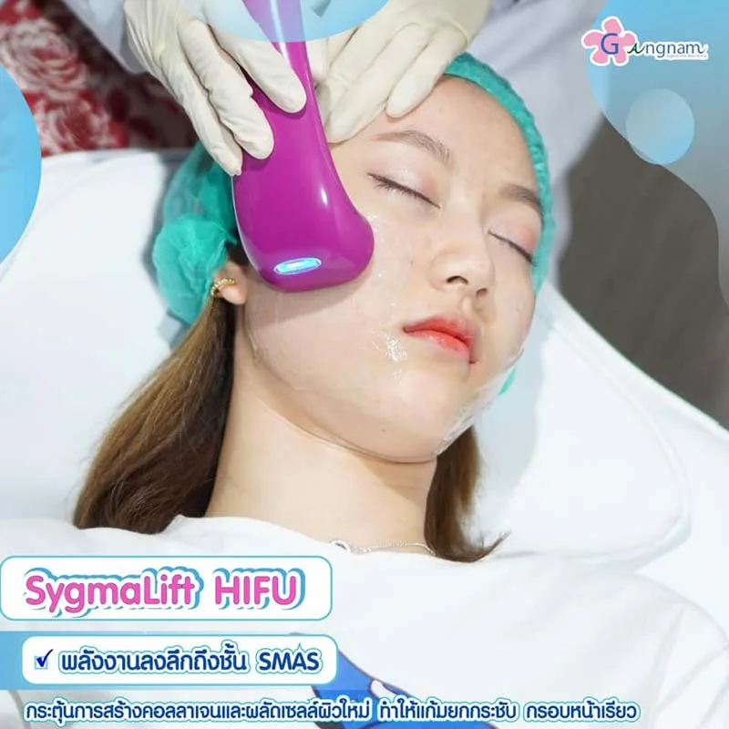 Sygmalift Hifu คือ