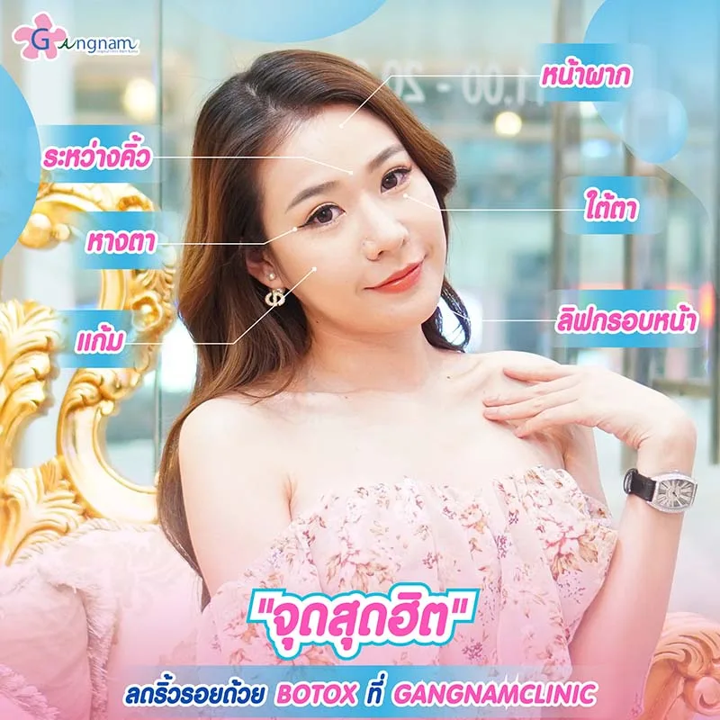 จุดที่นิยมฉีกโบท็อกลดริ้วรอย