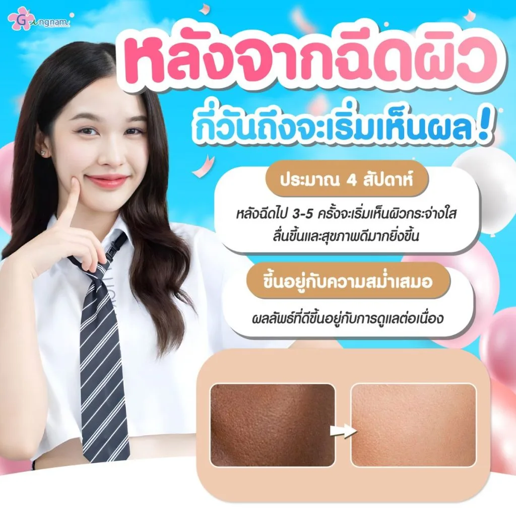 ฉีดผิวขาวกี่วันเห็นผล