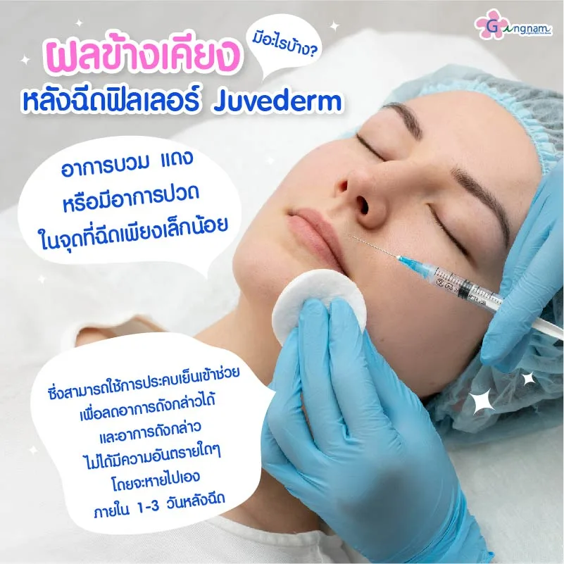 ผลข้างเคียงหลังฉีดฟิลเลอร์ Juvederm
