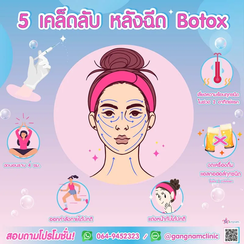การดูแลตัวเองหลังฉีดโบท็อก