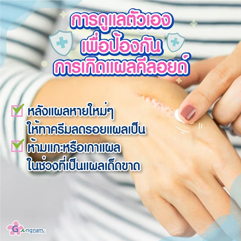 การดูแลรักษาแผลคีลอยด์ด้วยตัวเอง
