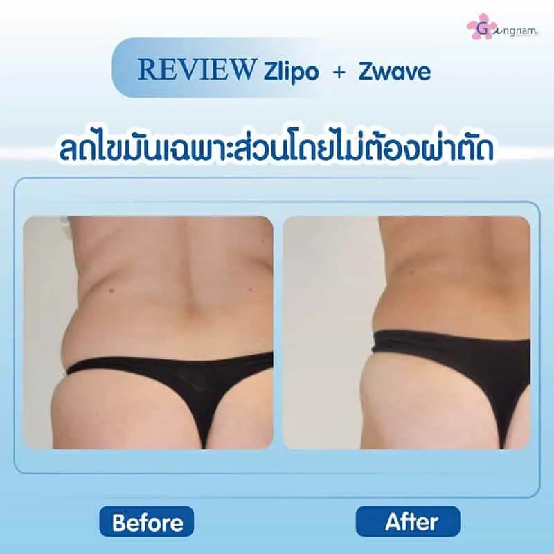 รีวิวลูกค้า 74