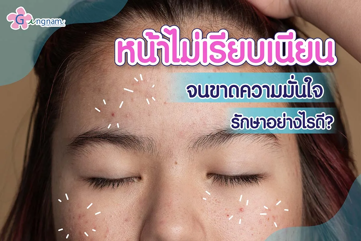 เผยสาเหตุ หน้าไม่เรียบเนียน เกิดจากอะไร? แก้ยังไงให้เห็นผลไวภายใน 2 เดือน
