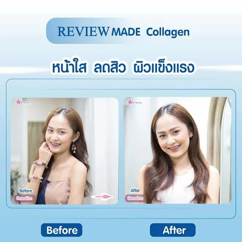 ฉีด made collagen ขับสารพิษบนหน้ารีวิวฉีด made collagen ขับสารพิษบนหน้า
