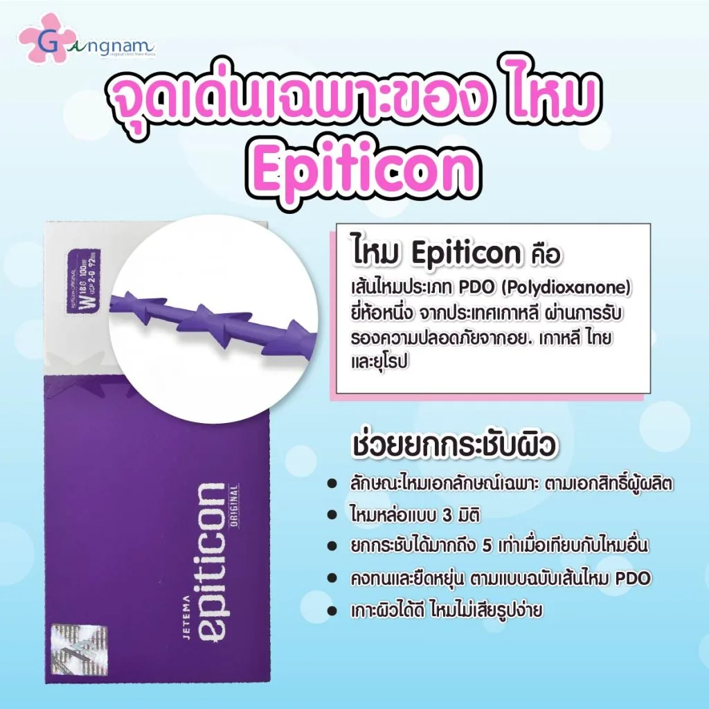 จุดเด่นไหม epiticon
