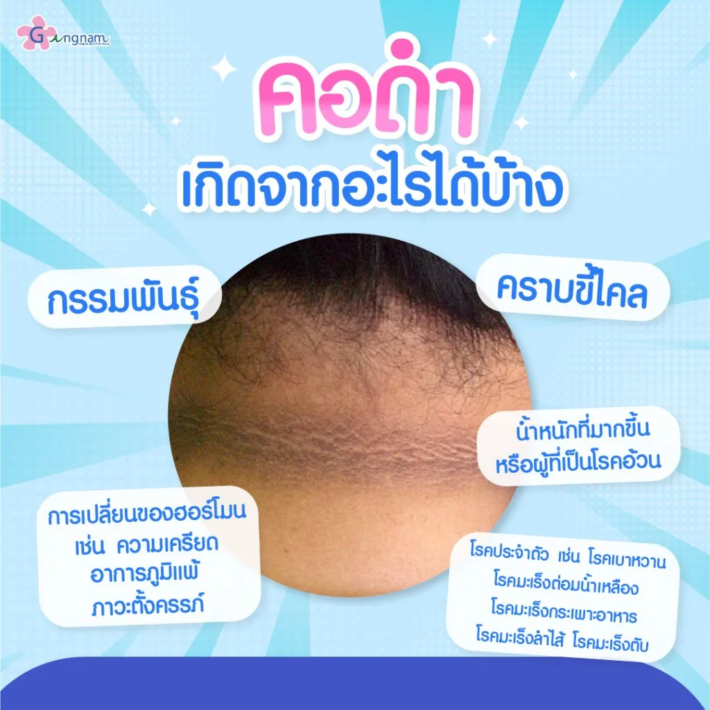 คอดำ เกิดจากสาเหตุอะไรบ้าง