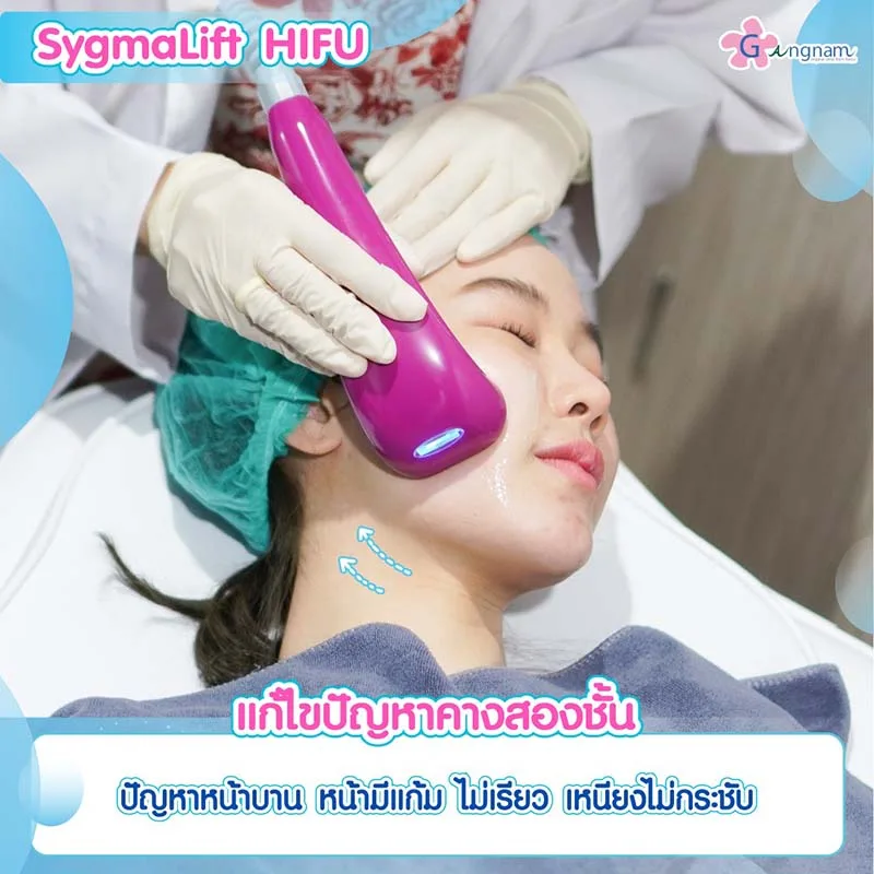 Sygmalift Hifu แก้ปัญหาเหนียงและคางสองชั้น