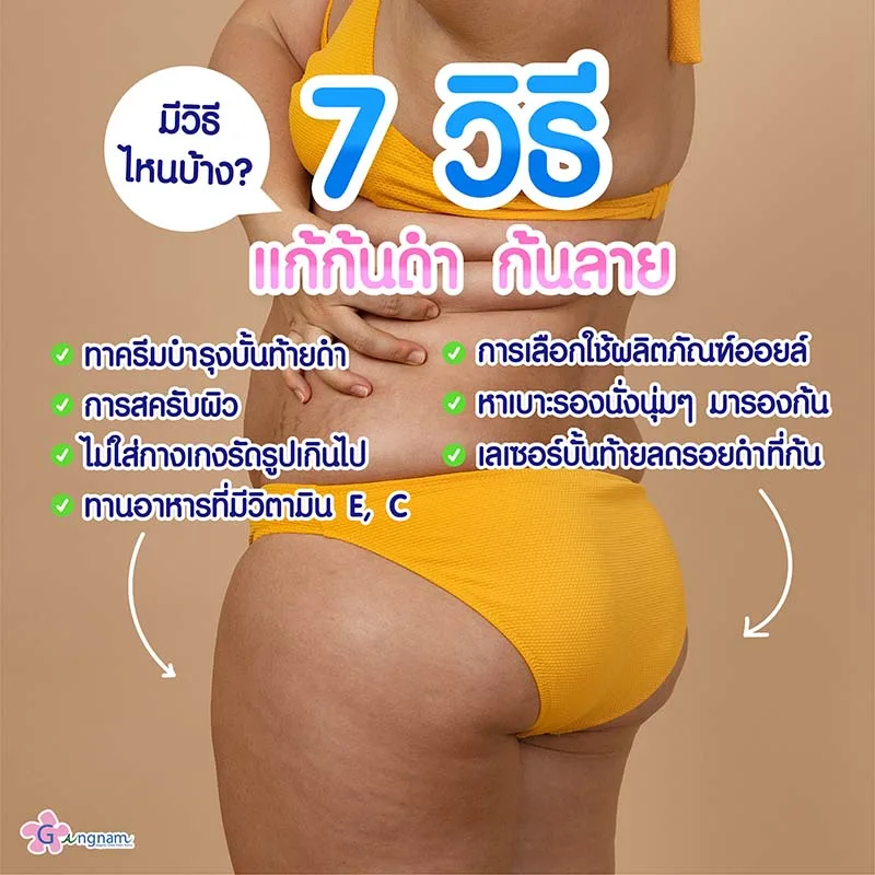 วิธี แก้ก้นดำ ก้นลาย แต่ละแบบ