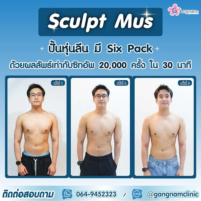 หลักการสร้างซิกแพคด้วย Emsculpt mus