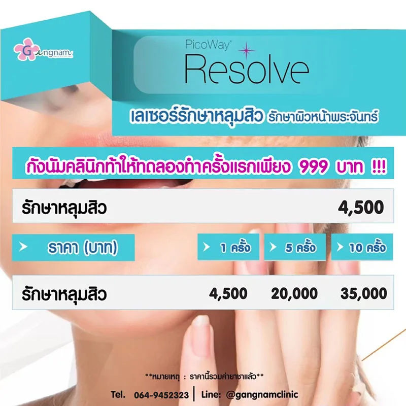 ราคาเลเซอร์หลุมสิว ครั้งละเท่าไหร่