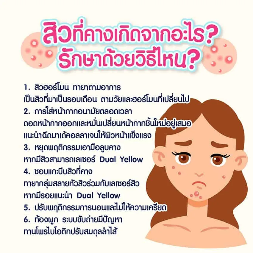 สิวที่คาง เกิดจากอะไร