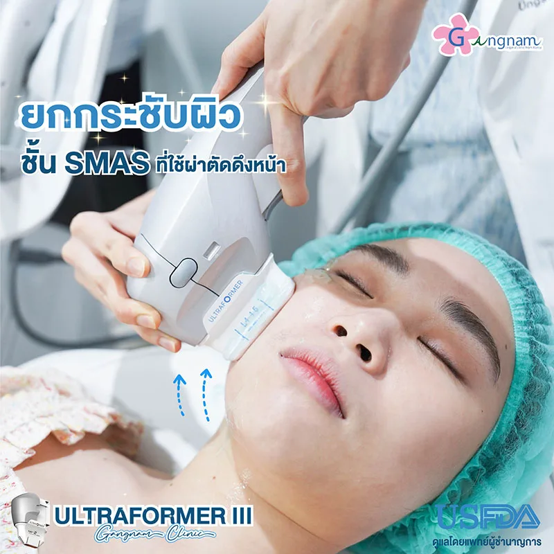 Ultraformer III ปรับรูปหน้า