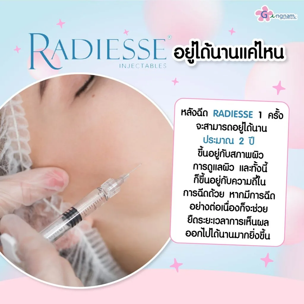 RADIESSE อยู่ได้กี่เดือน
