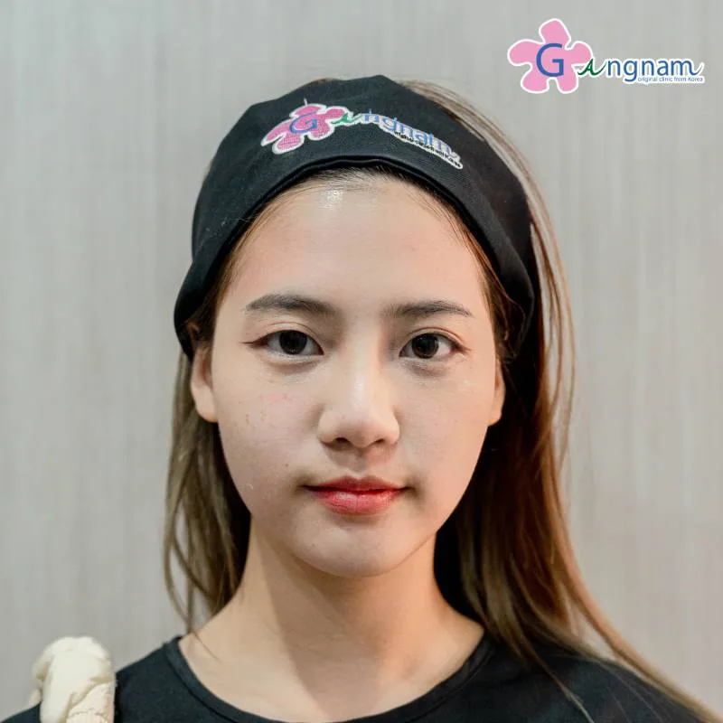คุณแพร หลังทำทันที
