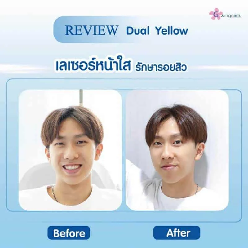 รีวิวลูกค้า 42