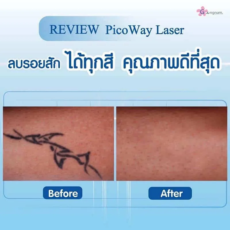 รีวิวลูกค้า 37