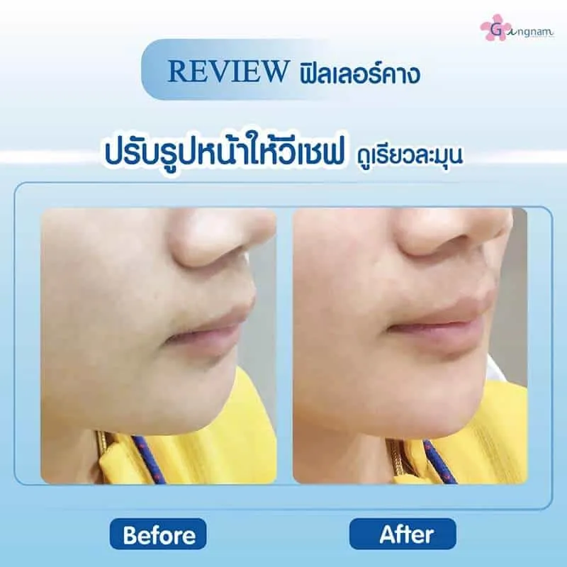รีวิวลูกค้า 77