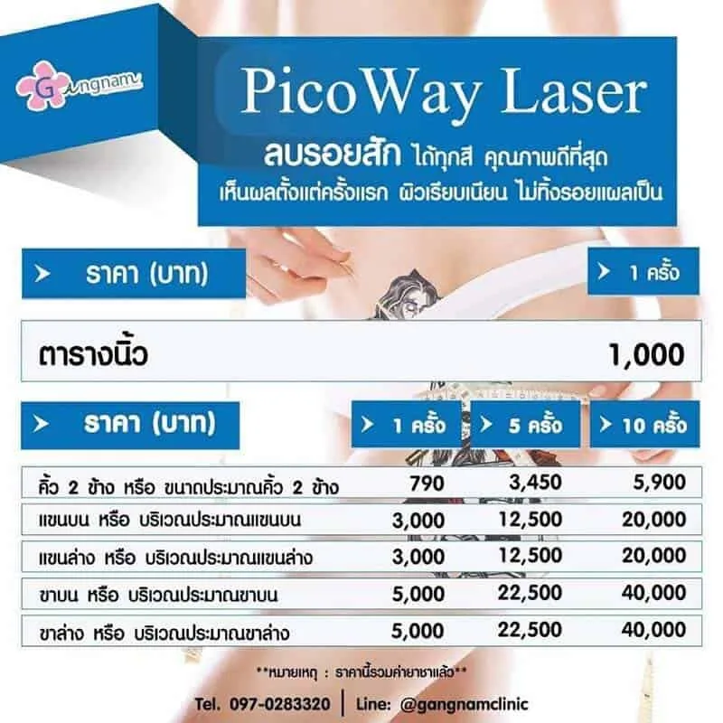 ตารางราคา เลเซอร์ลบรอยสัก
