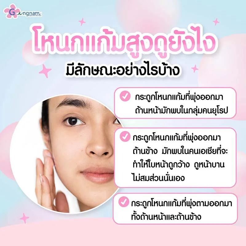 โหนกแก้มสูงดูยังไง-มีลักษณะอย่างไร
