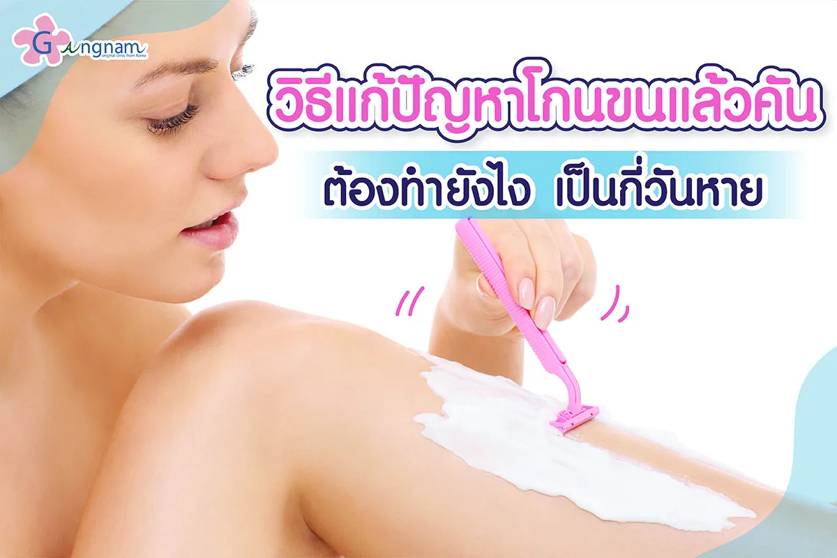 โกนขนแล้วคัน กี่วันหาย? มีวิธีแก้และบรรเทาอาการอย่างไร ให้หายคัน?