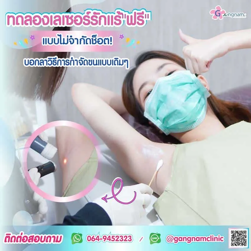 เลเซอร์กำจัดขนคุด