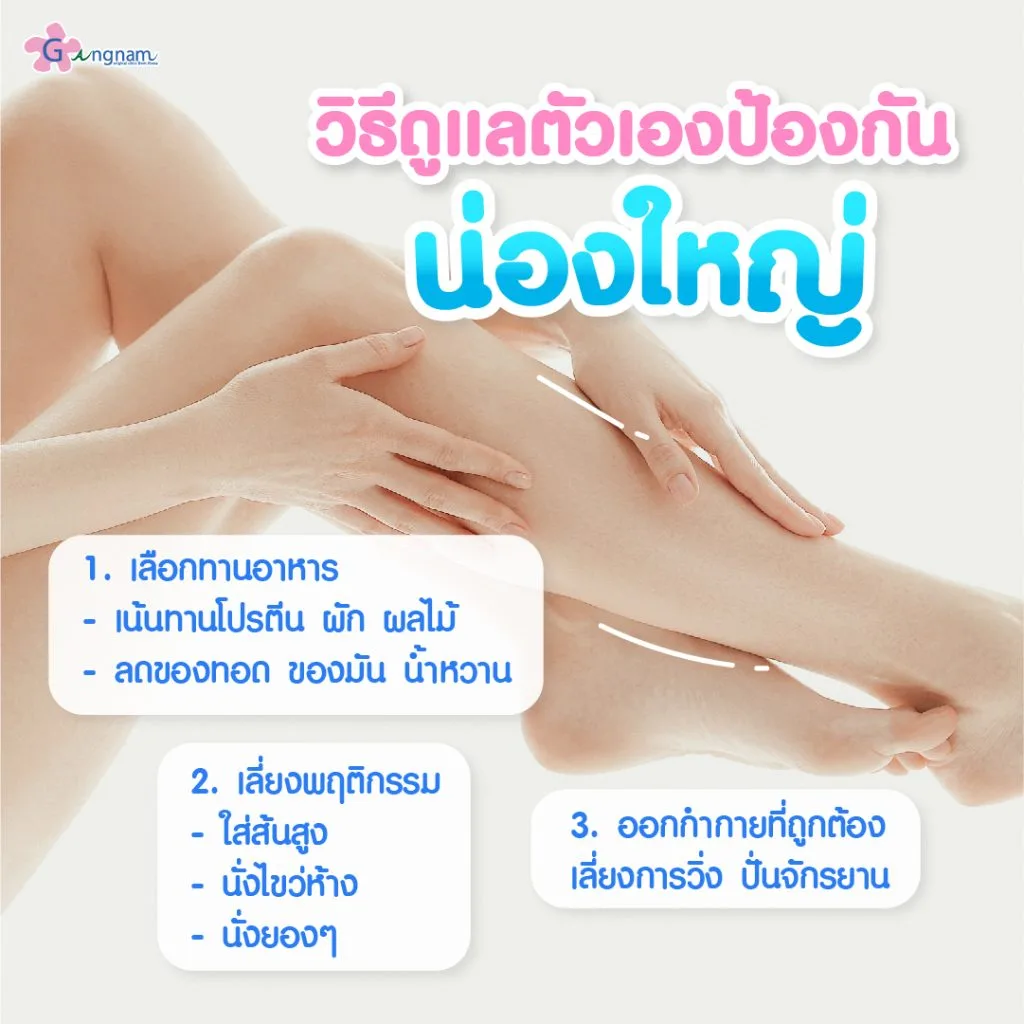 วิธีป้องกันปัญหาน่องใหญ่