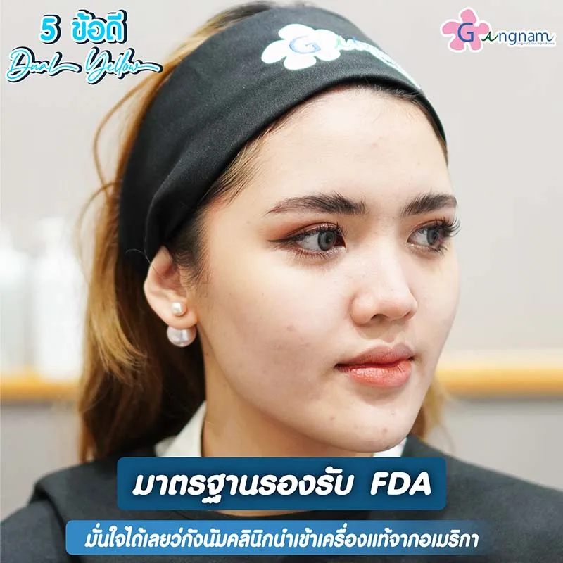 เลเซอร์รอยสิว ปลอดภัยไหม