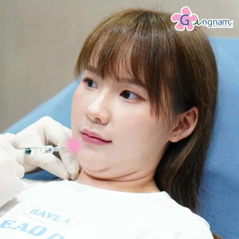 ฉีดเมโสแฟตลดเหนียงใต้คาง