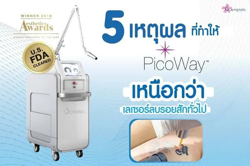 5 ข้อดีลบรอยสักด้วย picoway