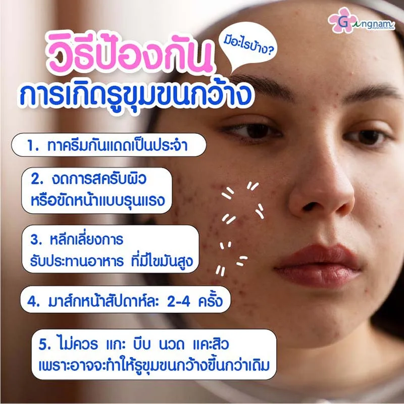 การป้องกันรูขุมขนกว้าง