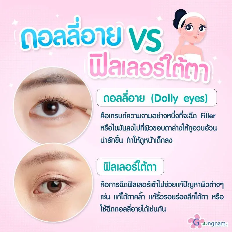 ดอลลี่อาย VS ฟิลเลอร์ใต้ตา