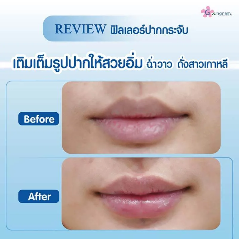 รีวิวลูกค้า 79