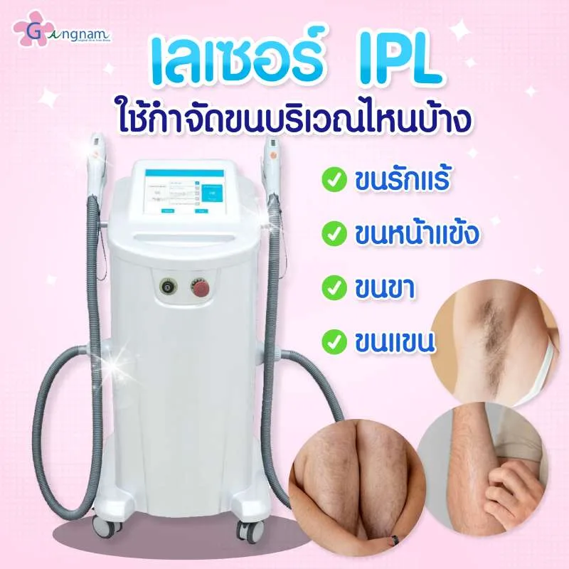 เลเซอร์ IPL ใช้กำจัดขนบริเวณไหนบ้า