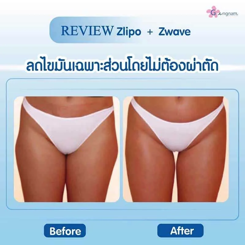 รีวิวลูกค้า 71