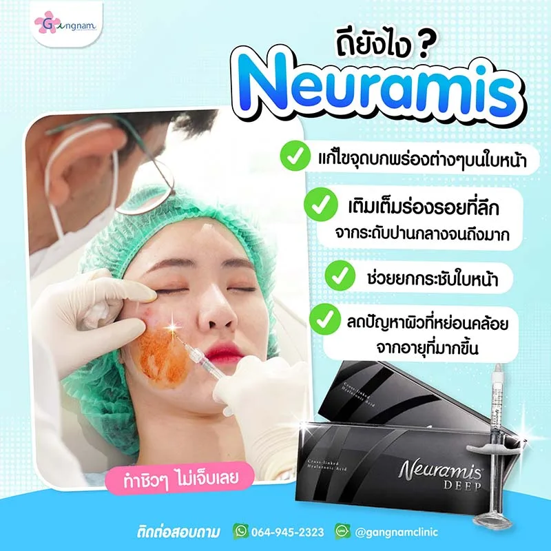neuramis ช่วยเรื่องอะไร