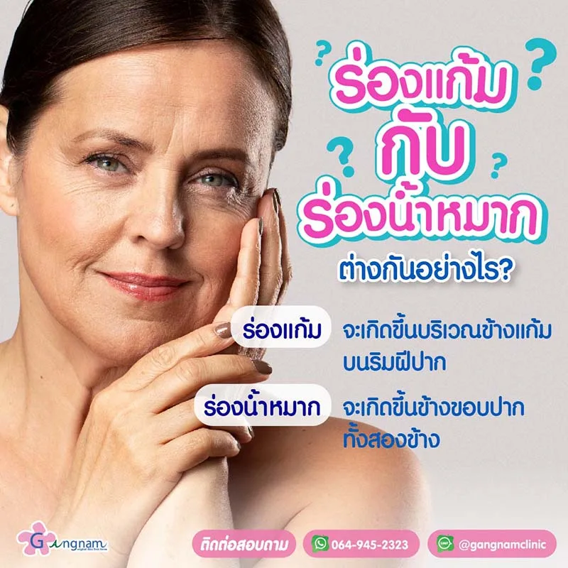 ร่องแก้มกับร่องน้ำหมาก