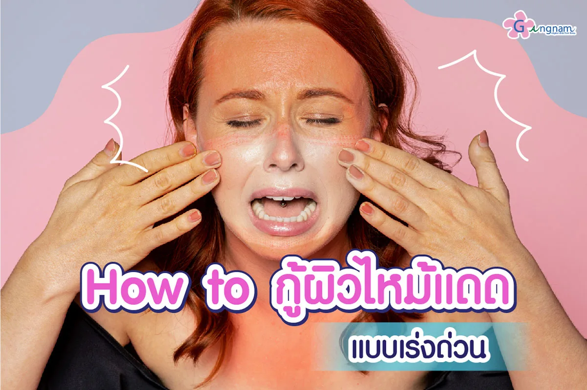รวม วิธีรักษาหน้าผิวไหม้แดด แบบเร่งด่วน พร้อมการดูแลเบื้องต้นก่อนรักษา
