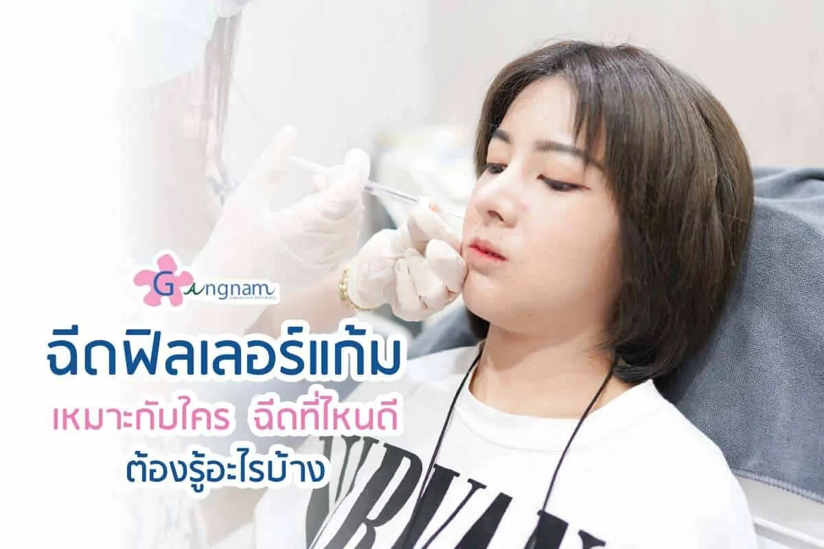 ฉีดฟิลเลอร์ร่องแก้ม เหมาะกับใคร ฉีดที่ไหนดี เติมบ่อยต้องอ่าน