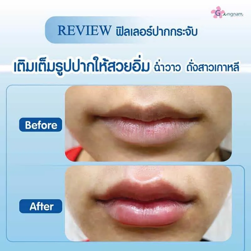 รีวิวลูกค้า 78