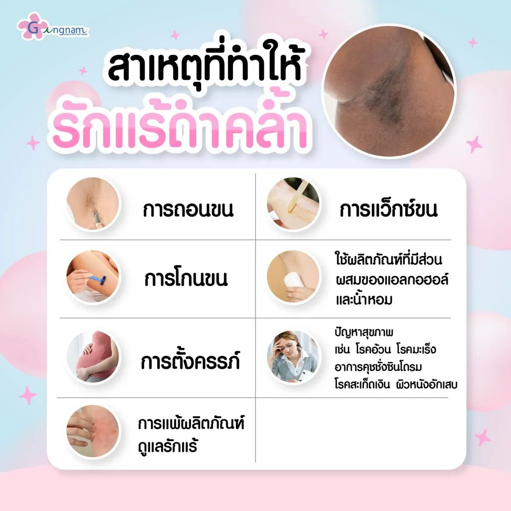 สาเหตุที่ทำให้รักแร้ดำคล้ำ