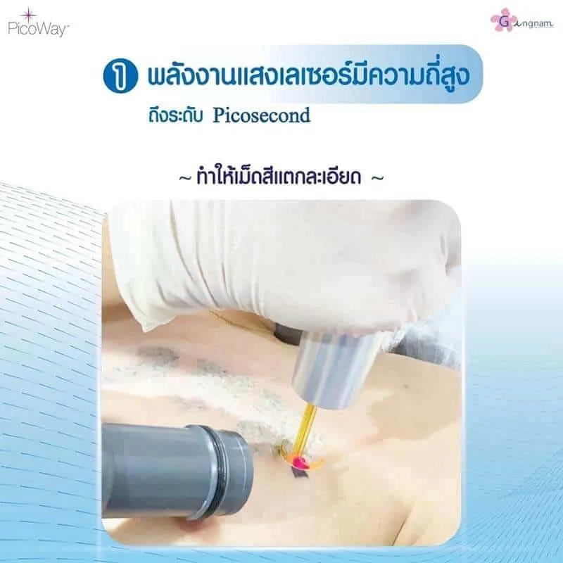 พลังงานแสงเลเซอร์ความถี่สูง