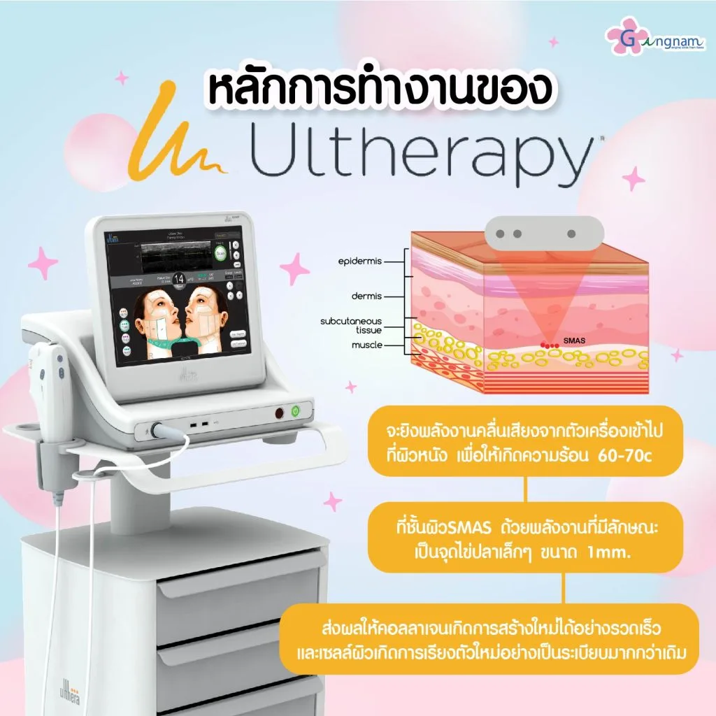 หลักการทำงานของ Ulthera