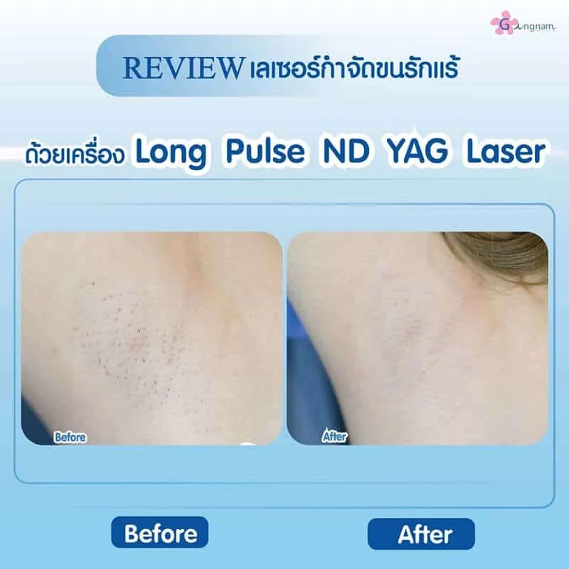 รีวิวลูกค้า 25