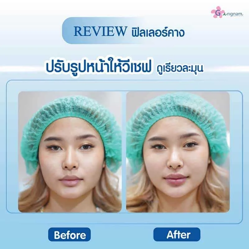 รีวิวลูกค้า 75