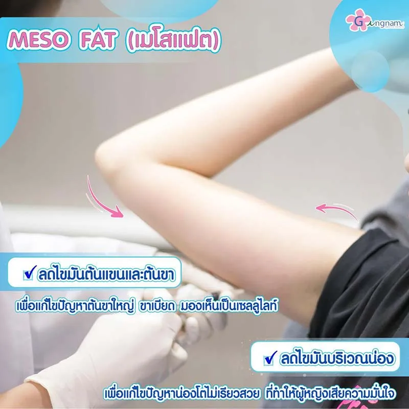 ฉีดเมโสแฟตต้นแขนใหญ่