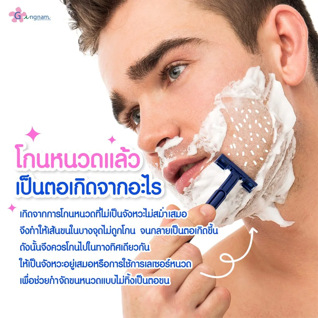 โกนหนวดแล้วเป็นตอเกิดจากอะไร