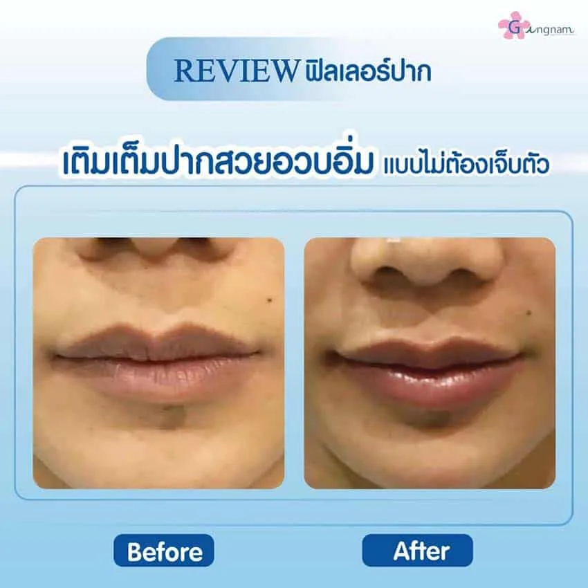 ปากบาง vs ปากสวยอวบอิ่ม